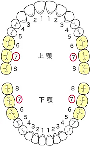 CAD/CAM冠の保険適用｜保険適用の白い被せ物・詰め物｜愛知県名古屋市中区・栄【長谷川亨・歯科クリニック】名古屋栄の歯医者・歯科医院