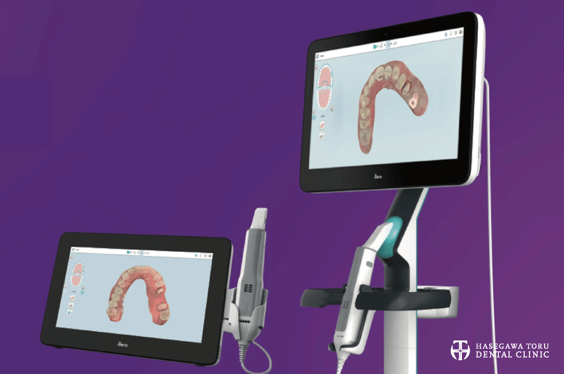 光学印象スキャナー・デジタルスキャナー｜iTero・アイテロ｜3Dスキャナー・歯の型取り｜愛知県名古屋市中区・栄【長谷川亨・歯科クリニック】名古屋栄の歯医者・歯科医院｜hasegawadental-nagoya.com
